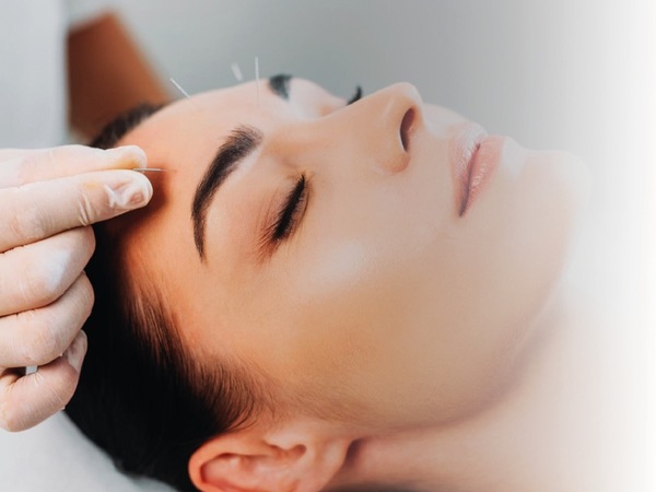 ACUPUNTURA FACIAL